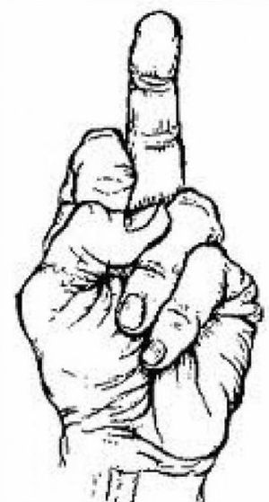 Lejos de los concursos de acreedores